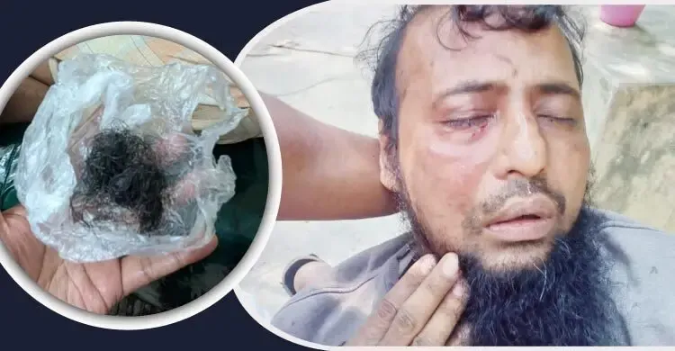 জামায়াত কর্মীকে পিটিয়ে দাড়ি উপড়ে দিলেন বিএনপি কর্মীরা