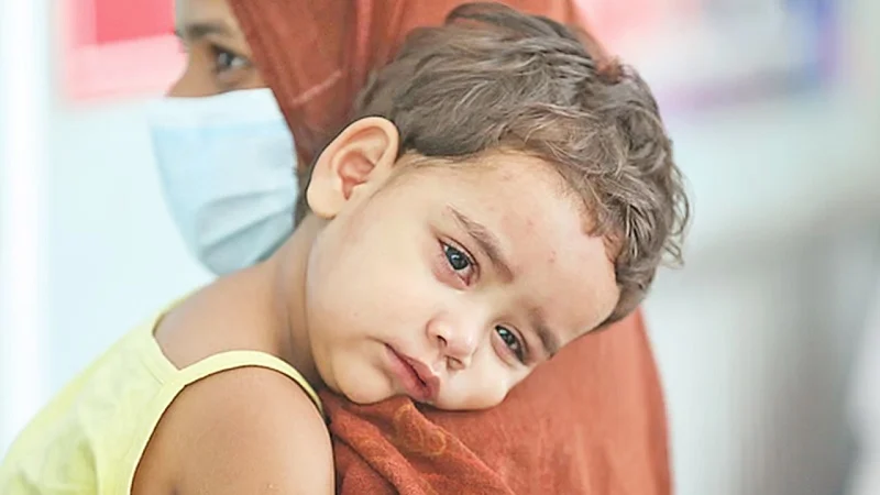 ২৪ ঘণ্টায় হামে আরও ৩ মৃত্যু, আক্রান্ত ৯৪৭