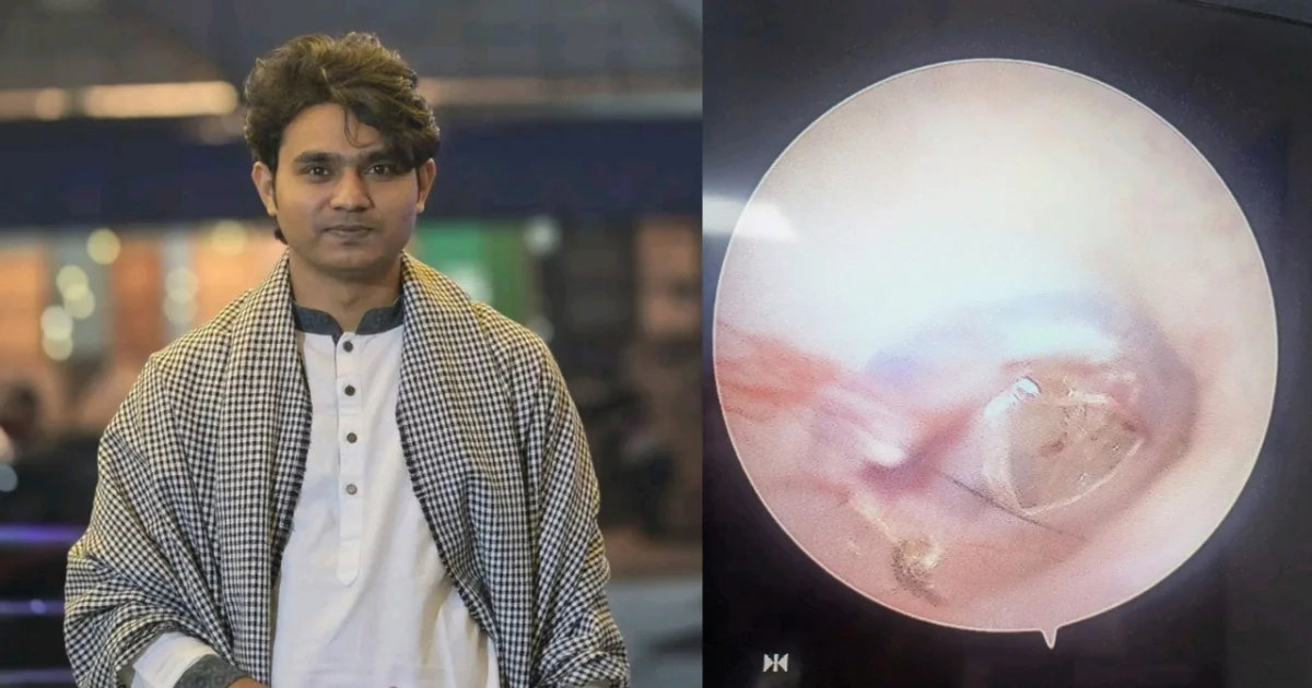 শাহবাগে ছাত্রদলের হামলার শিকার জুলহাসের কানের পর্দা ফেটে গেছে